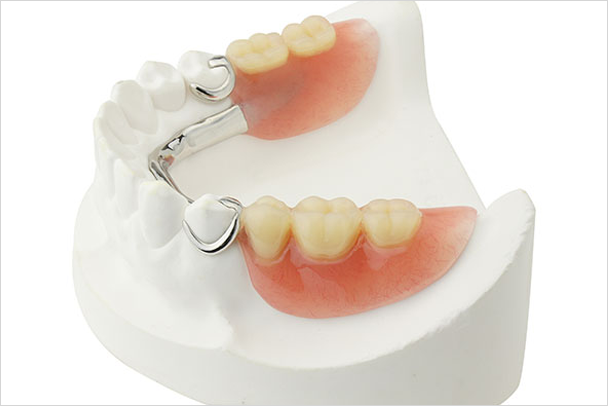 denture-img-2